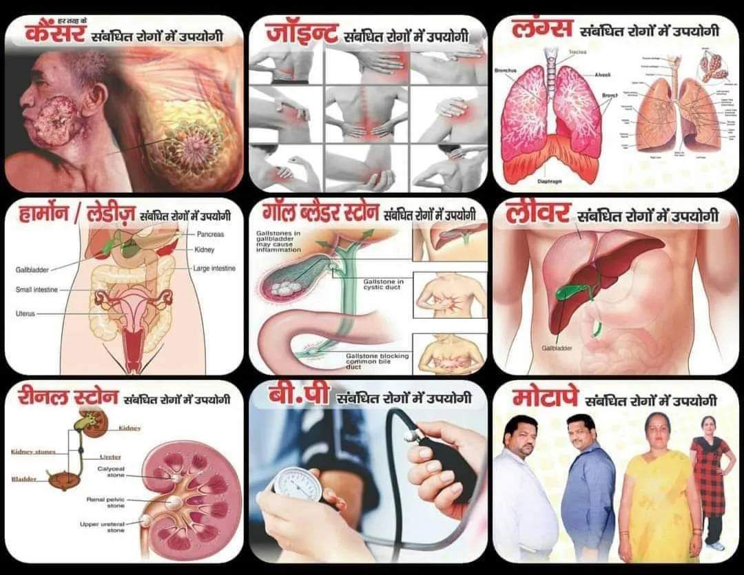 Load video: गंभीर से गंभीर बीमारी का सफल इलाज, आज ही अपनाएं रामबाण आचुक आयुर्वेद किट